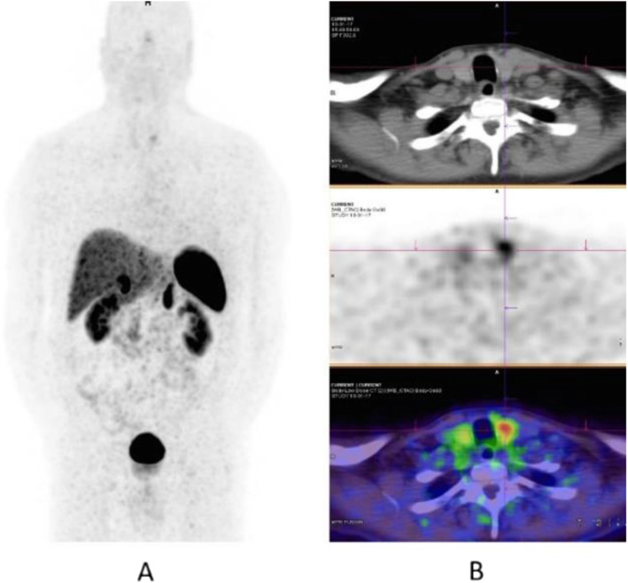 Fig. 62