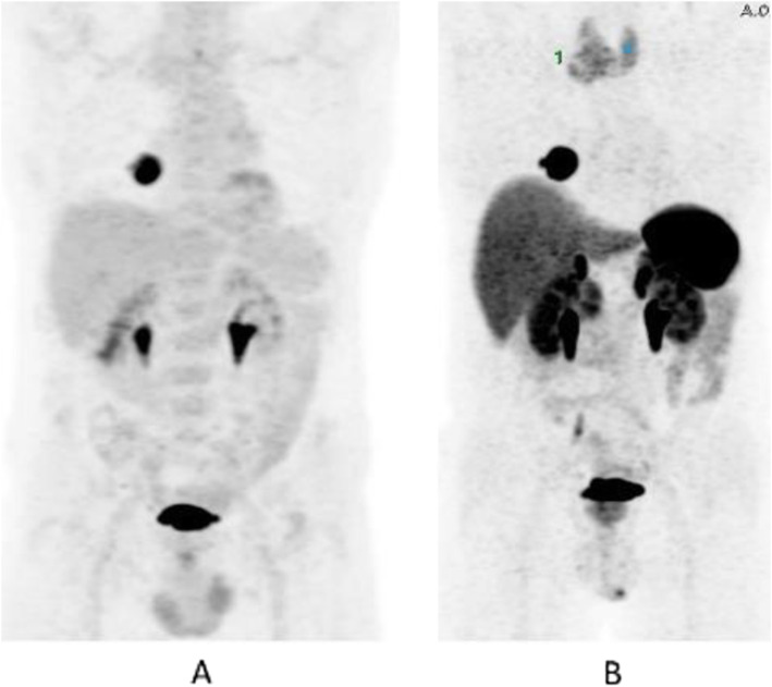 Fig. 52