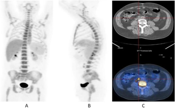 Fig. 14