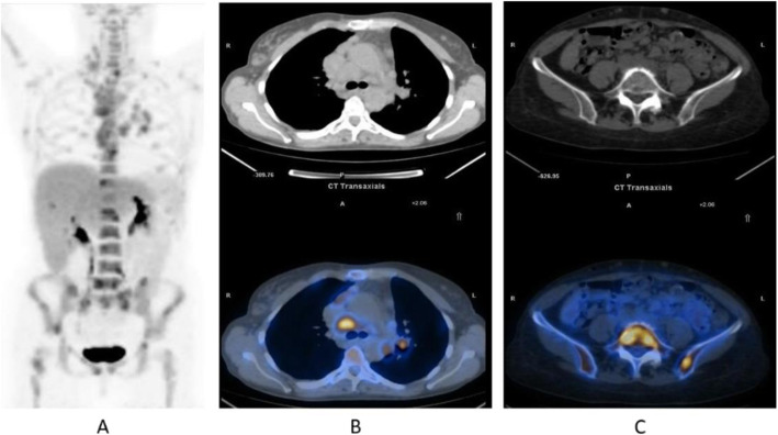 Fig. 12