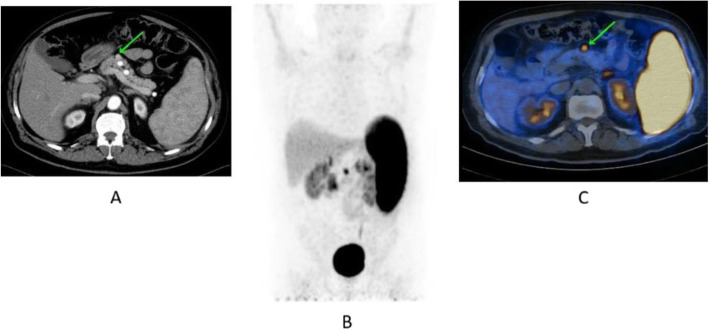 Fig. 48