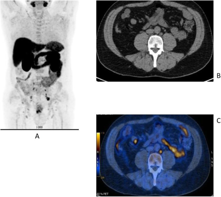 Fig. 20