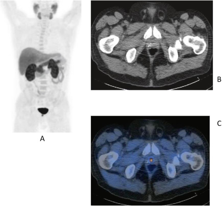 Fig. 23