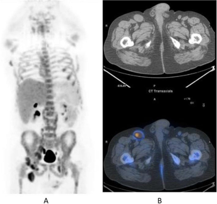 Fig. 13