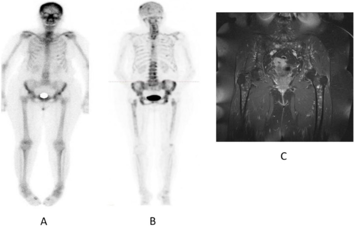 Fig. 71