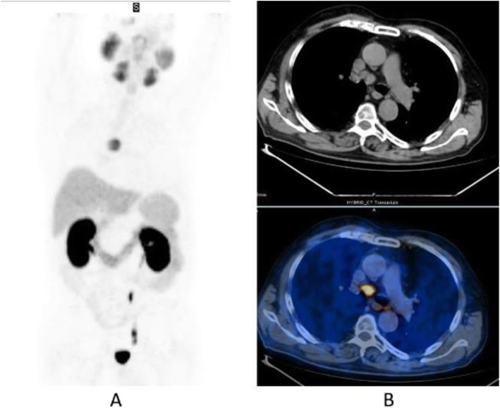 Fig. 33