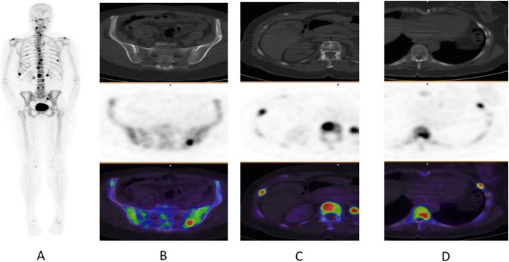 Fig. 70