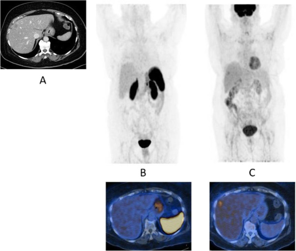 Fig. 54