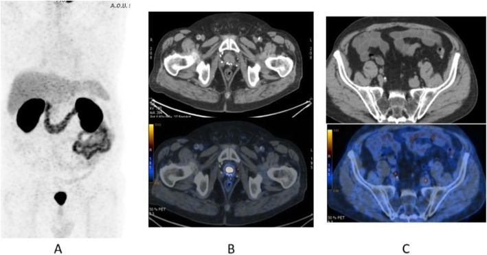 Fig. 32