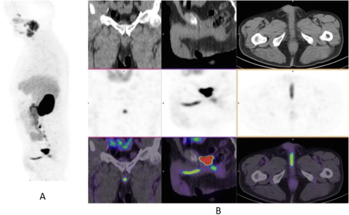 Fig. 30