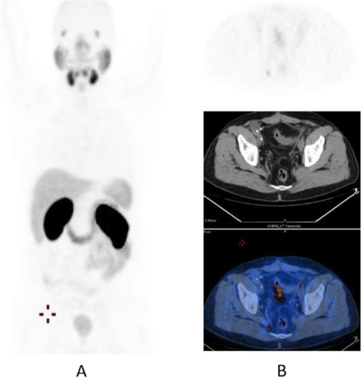 Fig. 28