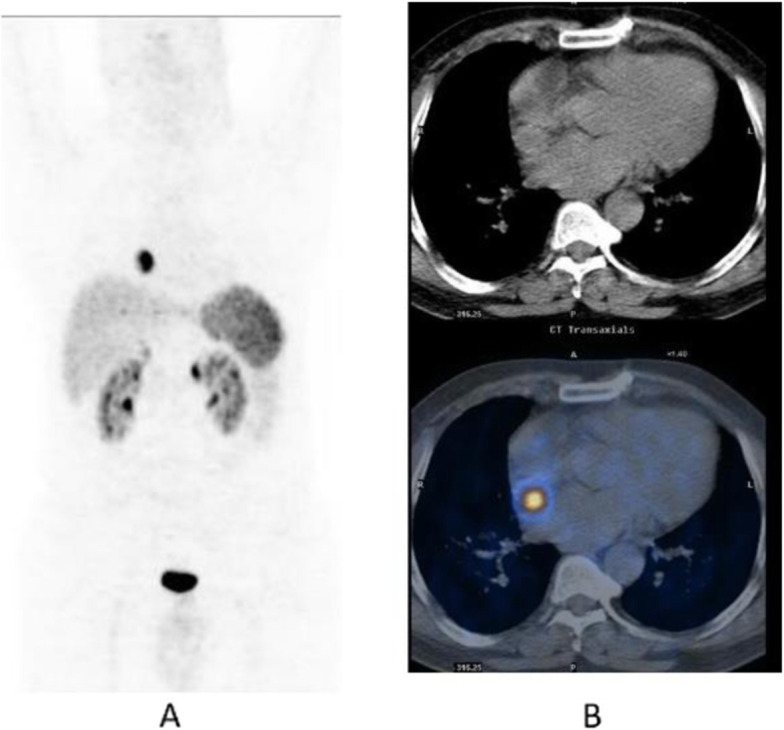 Fig. 61