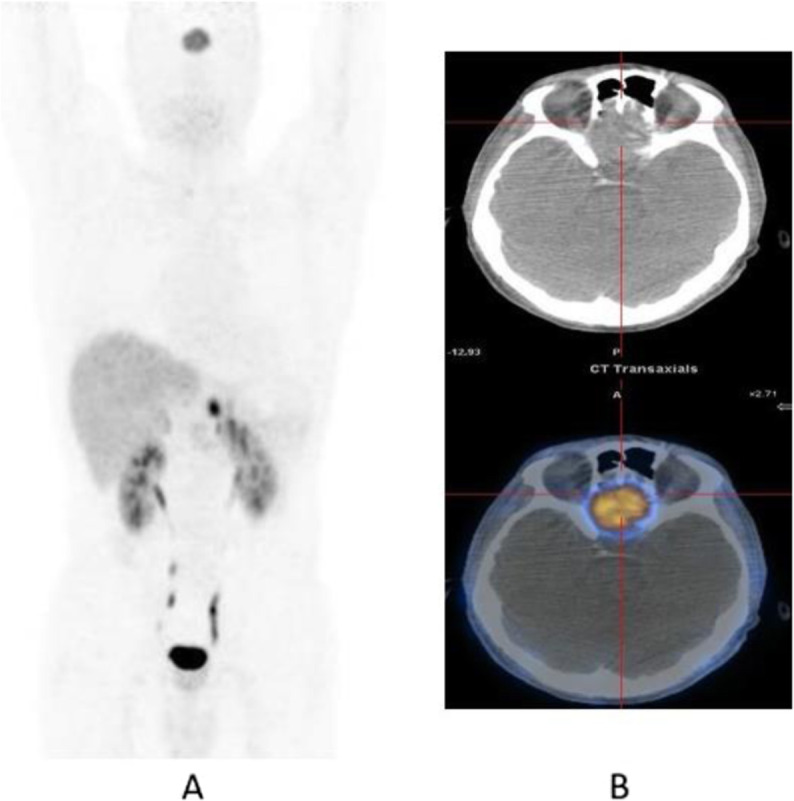 Fig. 65