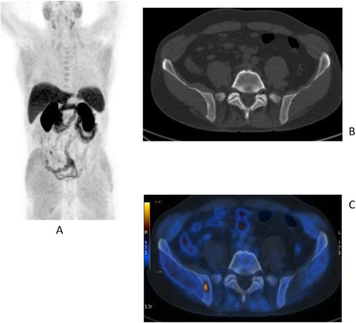 Fig. 21