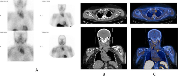 Fig. 18