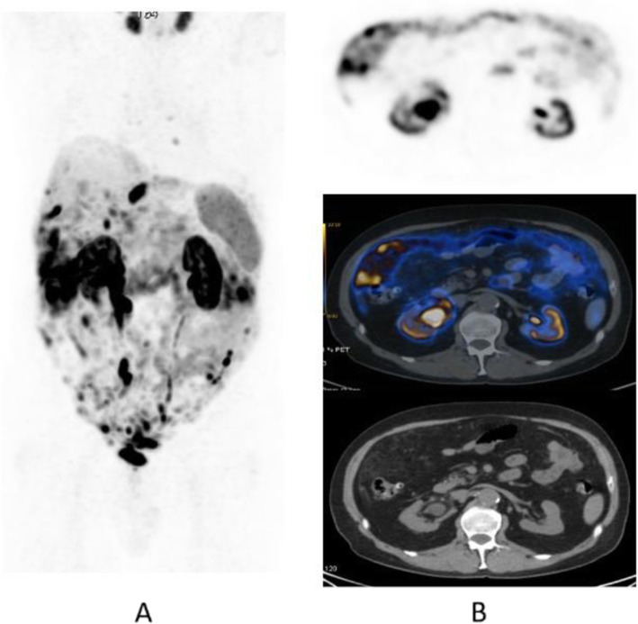 Fig. 35