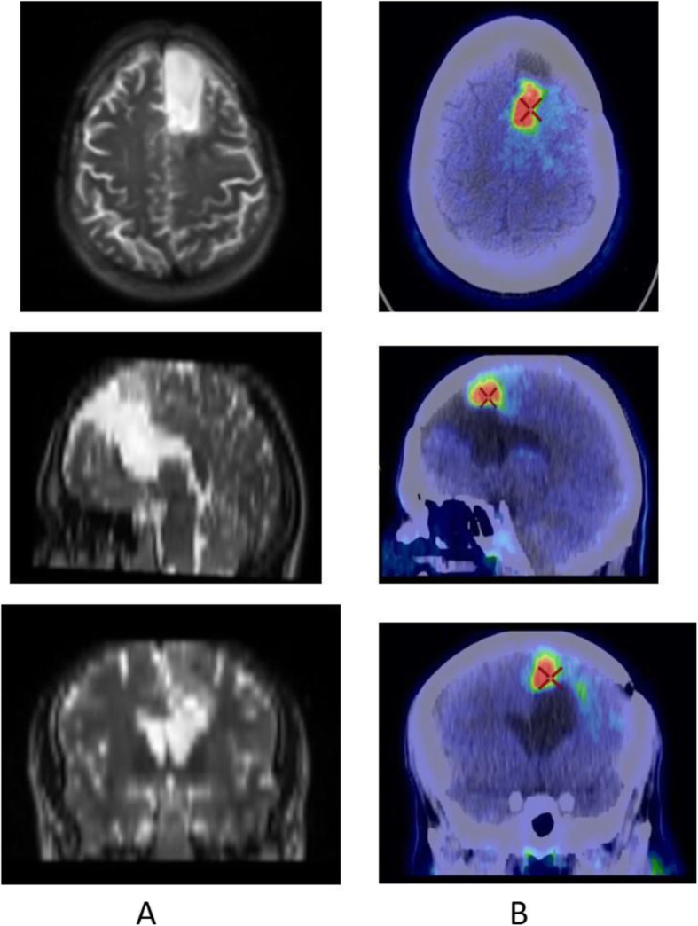 Fig. 17