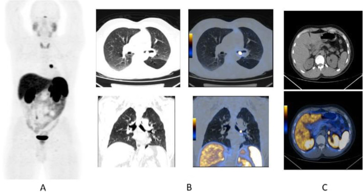 Fig. 51