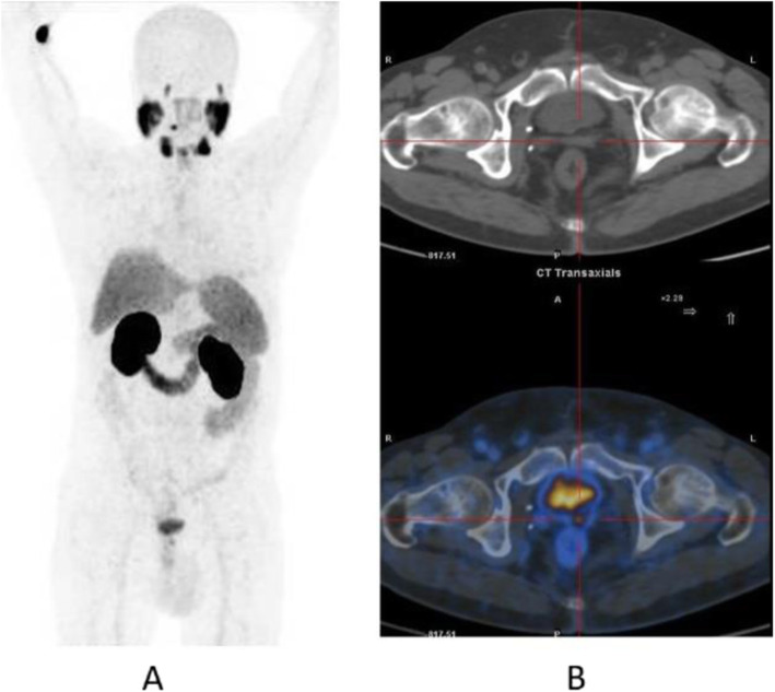 Fig. 29