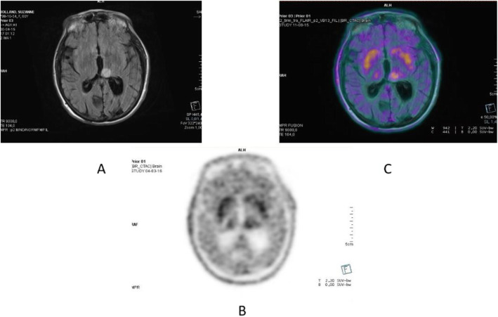 Fig. 39