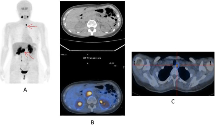 Fig. 40