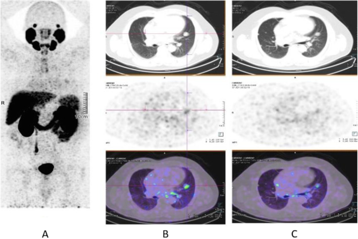 Fig. 36