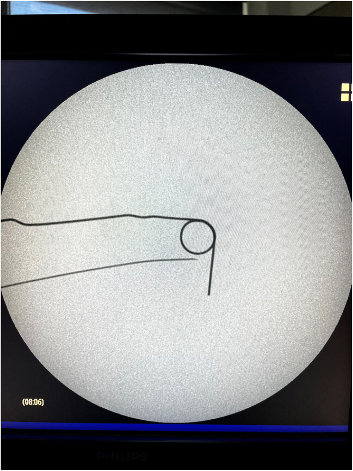 Fig. 2