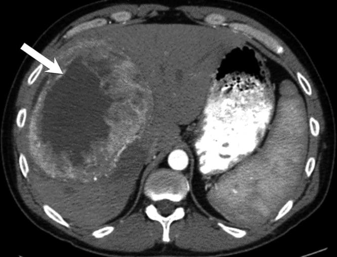 Figure 11.