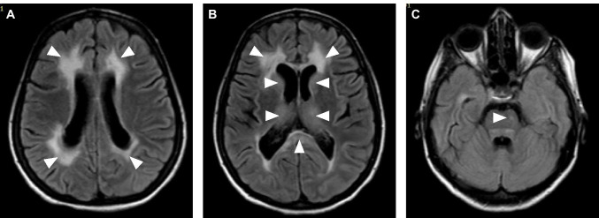 Fig. 1