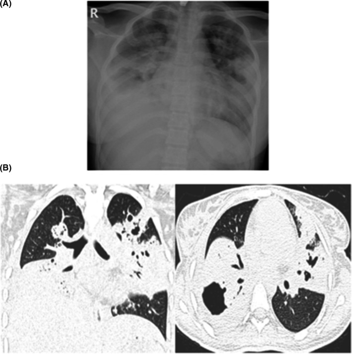 FIGURE 4