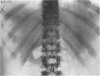 792-2