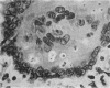 792-2