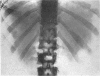 792-2