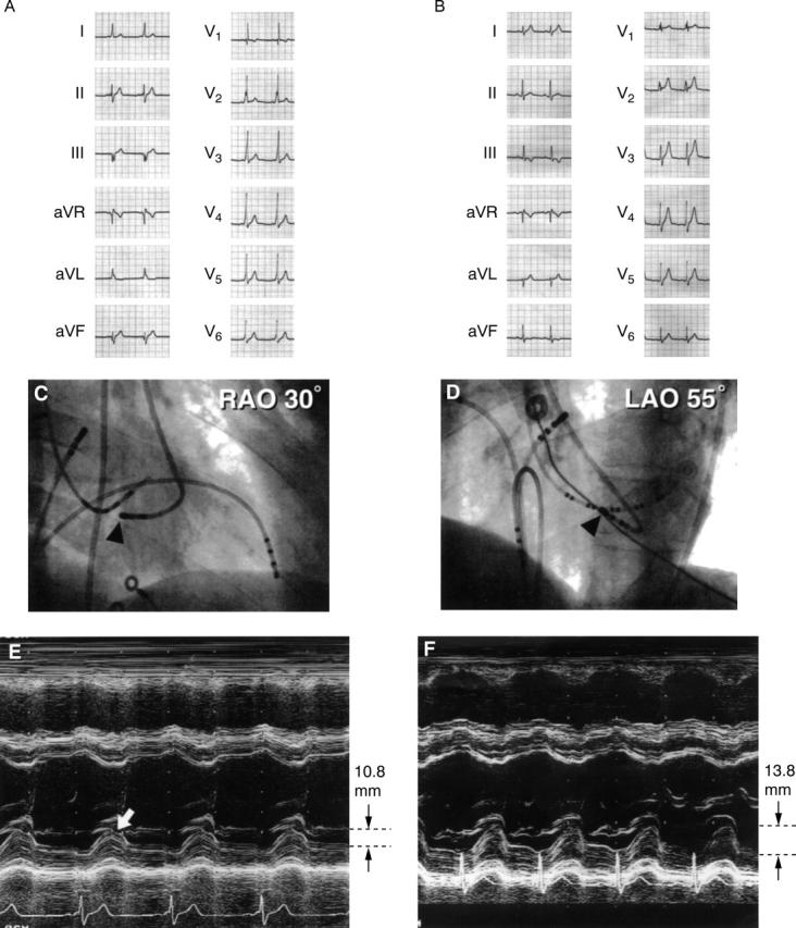 Figure 2  