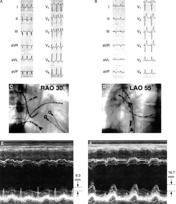 Figure 4  