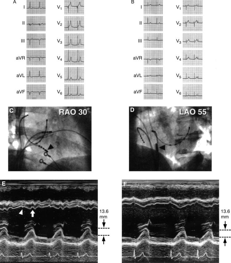 Figure 3  