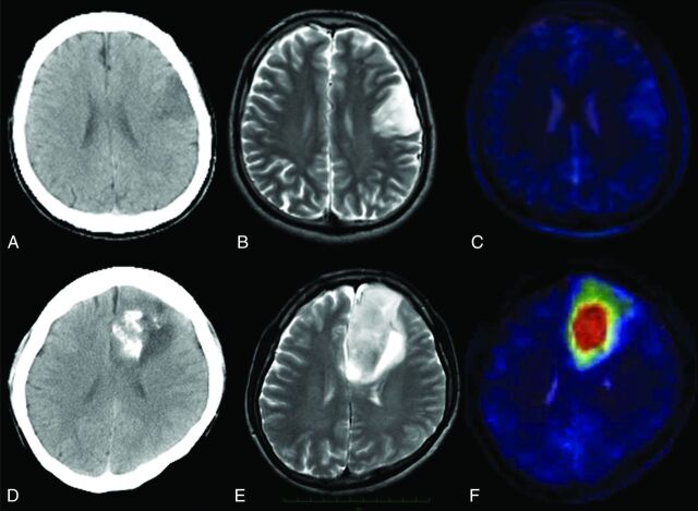 Fig 3.