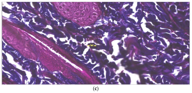 Figure 14