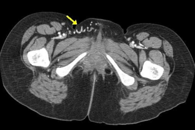 Figure 2A