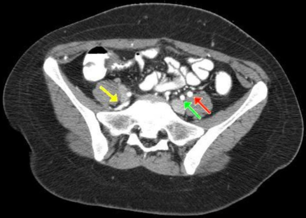 Figure 1B