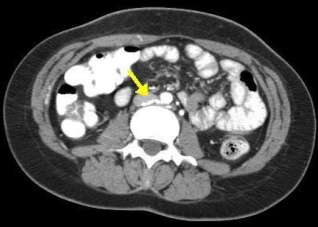 Figure 1C