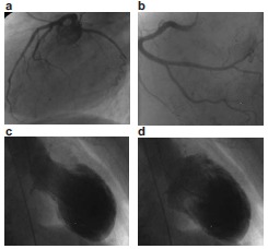 Fig. (3)