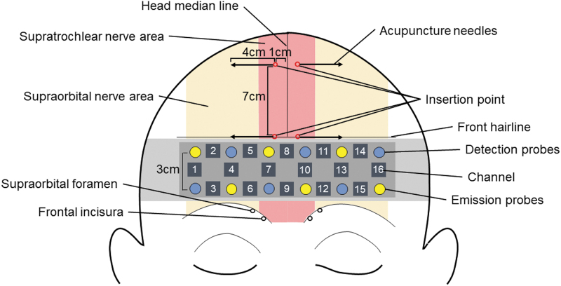 FIG. 1.