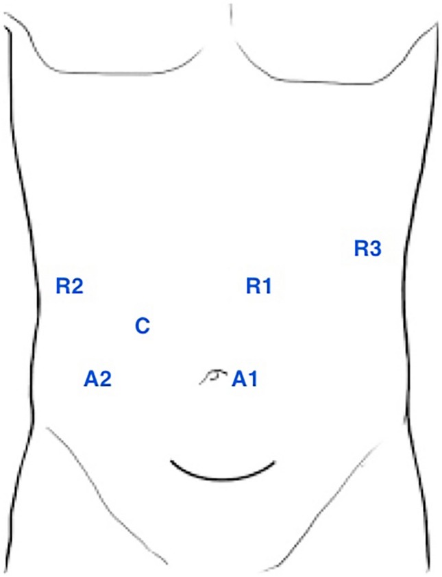 Fig. 2