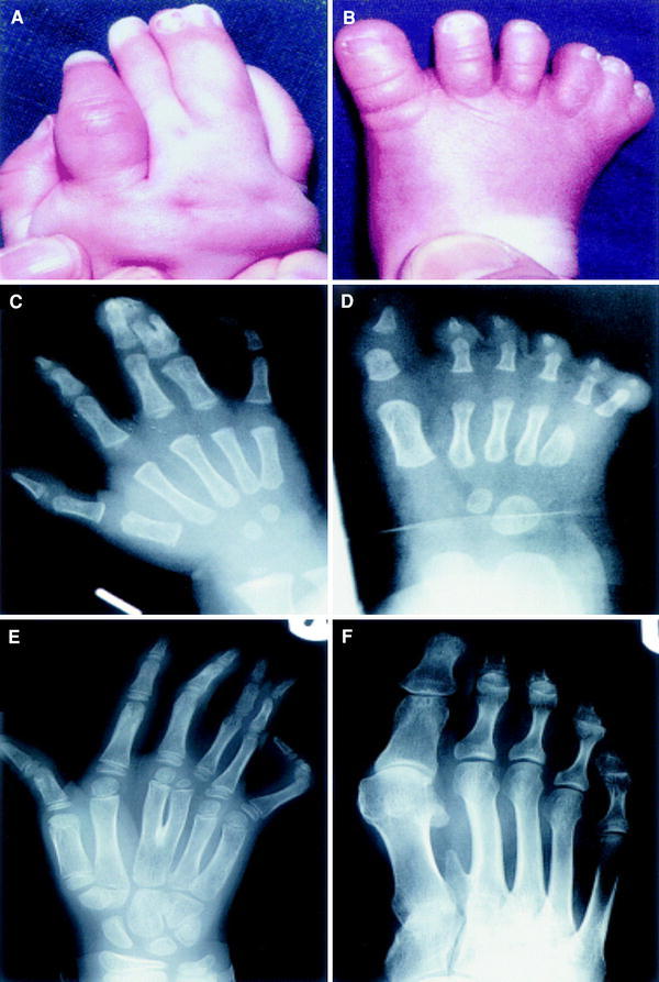 Fig. 4