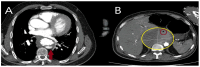Figure 17