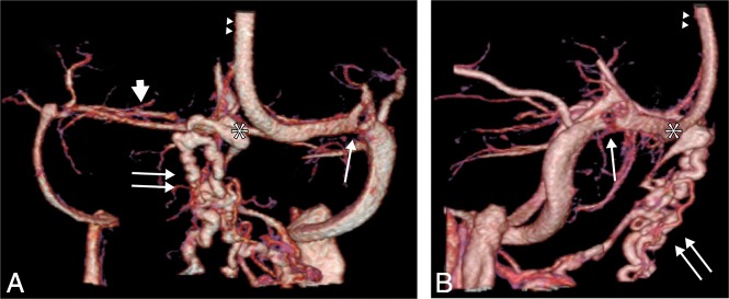 Fig 2.