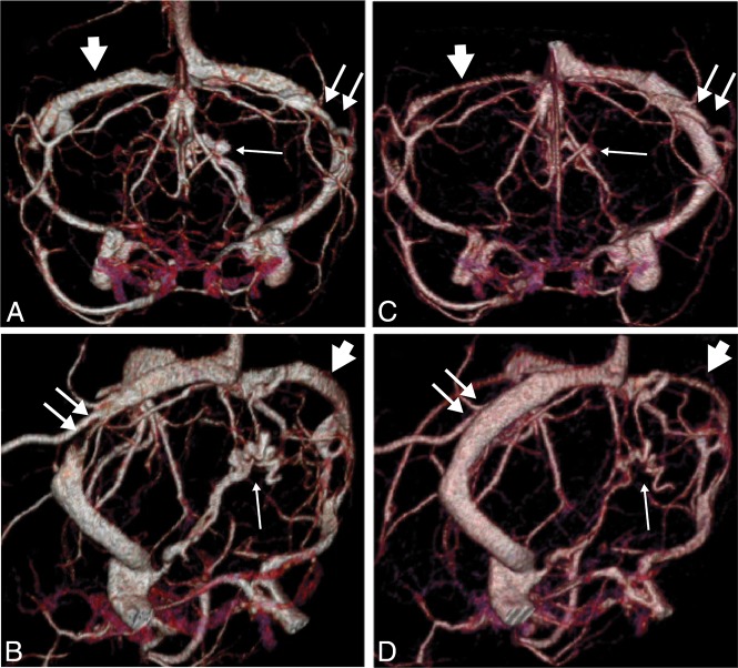 Fig 3.