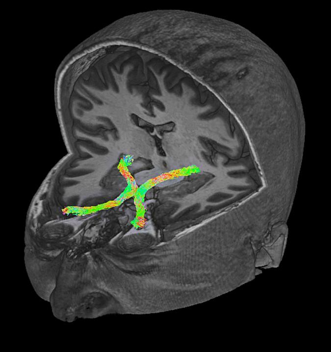 Fig. 1