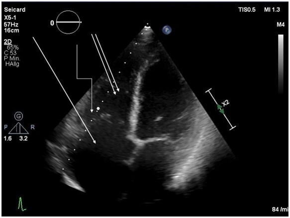 Figure 6